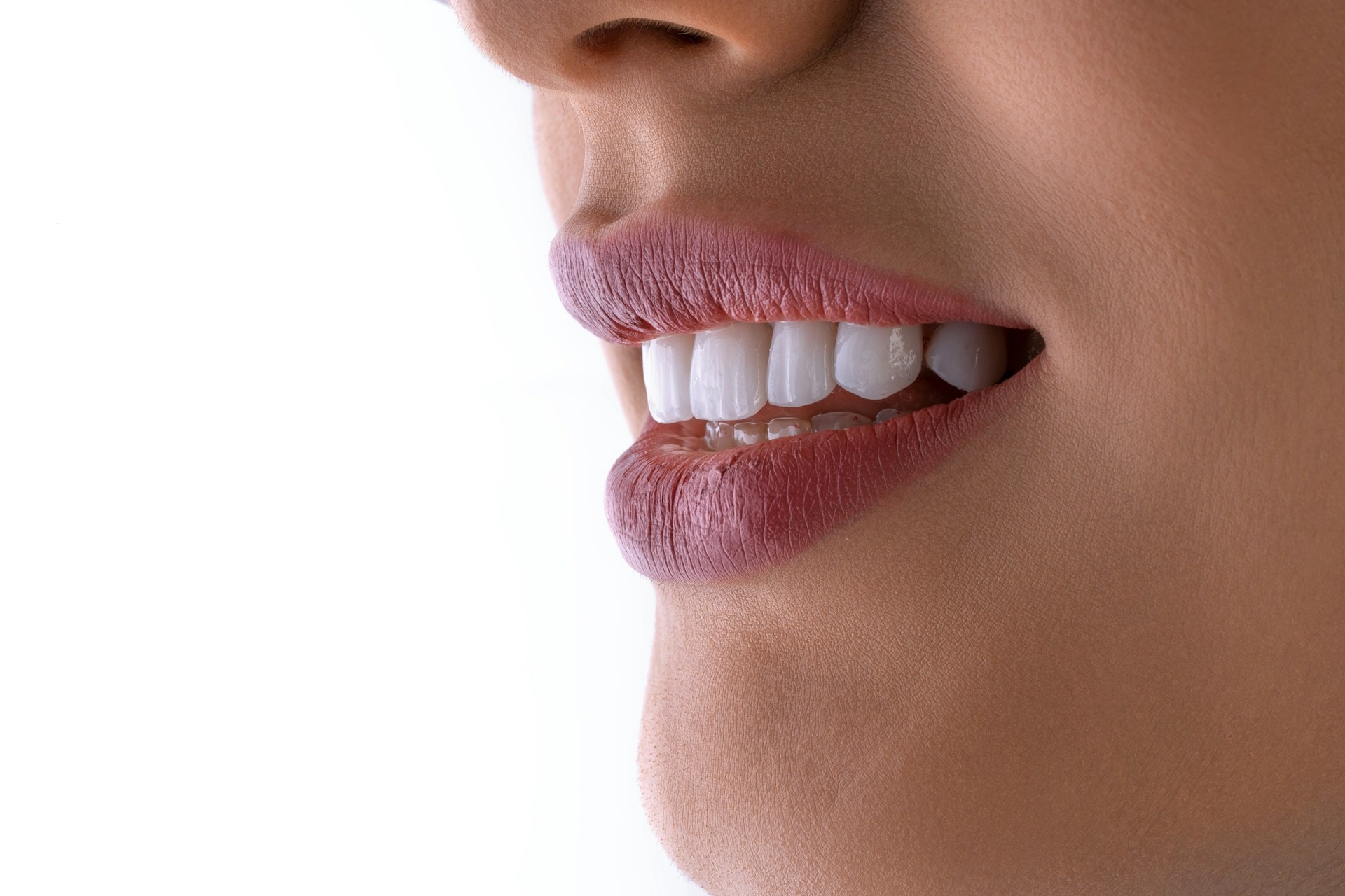 Close-up of a smile with perfectly aligned white dental veneers